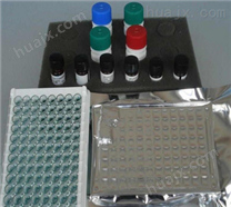 血小板衍生生长因子检测试剂盒,PDGF试剂盒